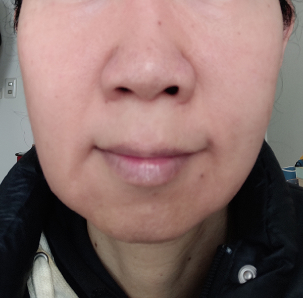 肌断食10年以上40代後半の写真